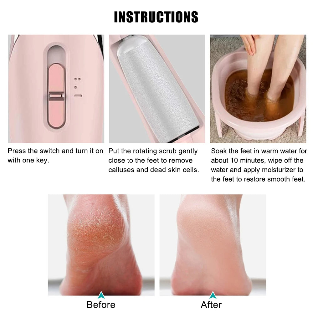 Electric Foot Pedicure File – Portable Dead Skin Remover & Callus Repair Tool 🦶✨