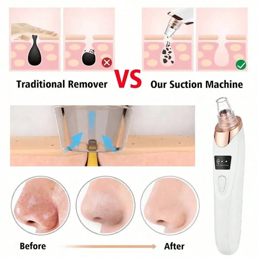 ClearGlow Deluxe Electric Pore & Blackhead Remover Vacuum for Facial Skin Care