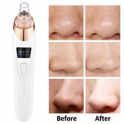ClearGlow Deluxe Electric Pore & Blackhead Remover Vacuum for Facial Skin Care