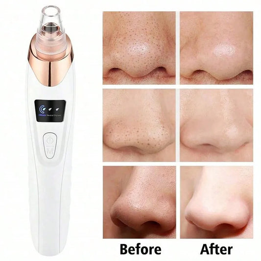 ClearGlow Deluxe Electric Pore & Blackhead Remover Vacuum for Facial Skin Care