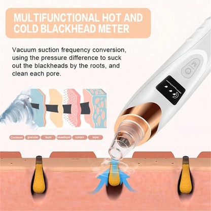 ClearGlow Deluxe Electric Pore & Blackhead Remover Vacuum for Facial Skin Care